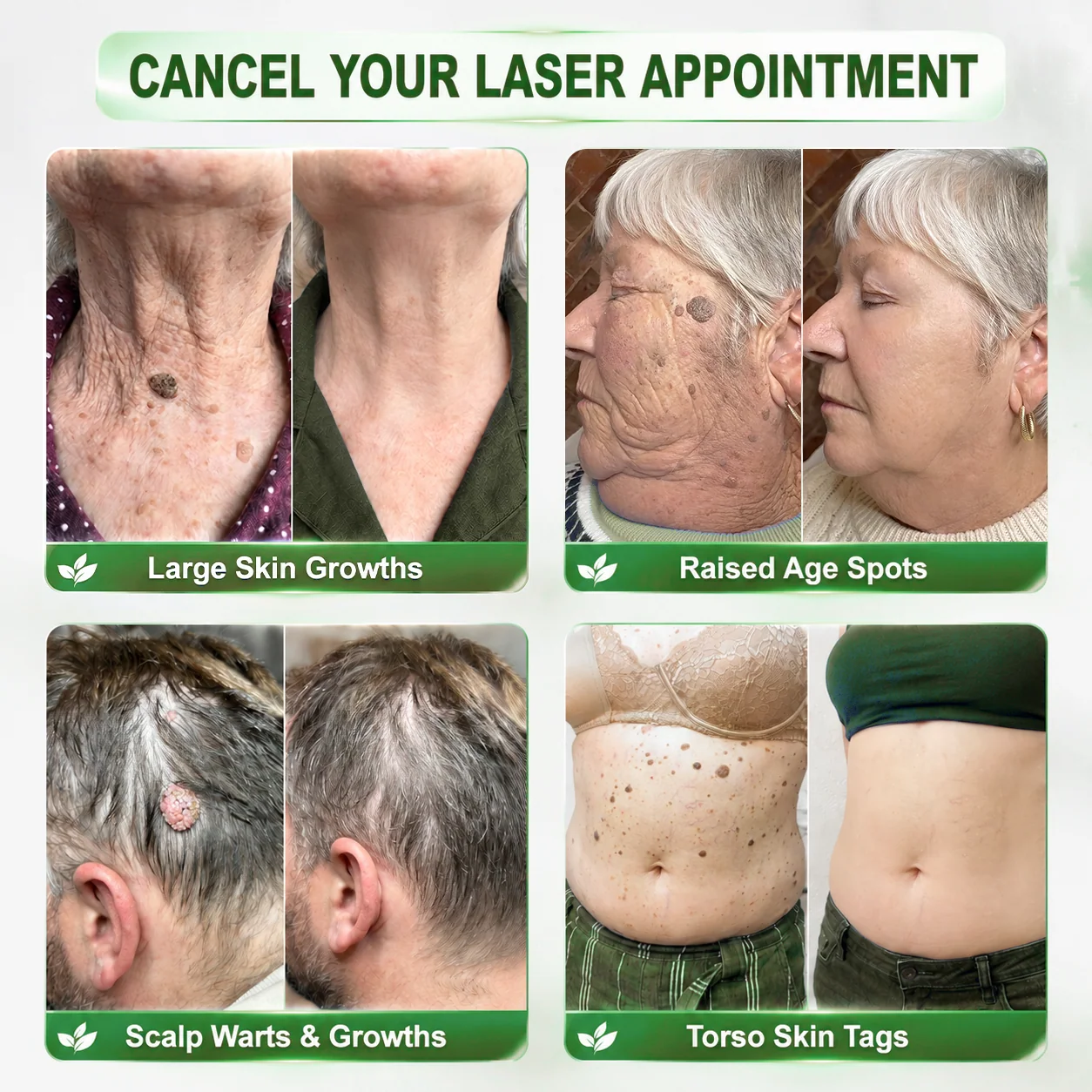 𝑯𝙞𝙨𝙠𝙞𝙣® 🧬𝑷𝑫𝑹𝑵 𝑨𝒏𝒕𝒊-𝑨𝒈𝒊𝒏𝒈 & 𝑻𝒂𝒓𝒈𝒆𝒕𝒆𝒅 𝑺𝒑𝒐𝒕 𝑹𝒆𝒏𝒆𝒘𝒂𝒍 𝑺𝒕𝒊𝒄𝒌（𝑯𝒆𝒍𝒑𝒔 𝑺𝒎𝒐𝒐𝒕𝒉 𝑾𝒓𝒊𝒏𝒌𝒍𝒆𝒔, 𝑺𝒖𝒑𝒑𝒐𝒓𝒕 𝑭𝒊𝒓𝒎𝒆𝒓-𝑳𝒐𝒐𝒌𝒊𝒏𝒈 𝑺𝒌𝒊𝒏, 𝒂𝒏𝒅 𝑰𝒎𝒑𝒓𝒐𝒗𝒆 𝑻𝒉𝒆 𝑨𝒑𝒑𝒆𝒂𝒓𝒂𝒏𝒄𝒆 𝑶𝒇 𝑽𝒊𝒔𝒊𝒃𝒍𝒆 𝑺𝒑𝒐𝒕𝒔）