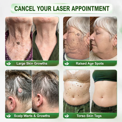 𝑯𝙞𝙨𝙠𝙞𝙣® 🧬𝑷𝑫𝑹𝑵 𝑨𝒏𝒕𝒊-𝑨𝒈𝒊𝒏𝒈 & 𝑻𝒂𝒓𝒈𝒆𝒕𝒆𝒅 𝑺𝒑𝒐𝒕 𝑹𝒆𝒏𝒆𝒘𝒂𝒍 𝑺𝒕𝒊𝒄𝒌（𝑯𝒆𝒍𝒑𝒔 𝑺𝒎𝒐𝒐𝒕𝒉 𝑾𝒓𝒊𝒏𝒌𝒍𝒆𝒔, 𝑺𝒖𝒑𝒑𝒐𝒓𝒕 𝑭𝒊𝒓𝒎𝒆𝒓-𝑳𝒐𝒐𝒌𝒊𝒏𝒈 𝑺𝒌𝒊𝒏, 𝒂𝒏𝒅 𝑰𝒎𝒑𝒓𝒐𝒗𝒆 𝑻𝒉𝒆 𝑨𝒑𝒑𝒆𝒂𝒓𝒂𝒏𝒄𝒆 𝑶𝒇 𝑽𝒊𝒔𝒊𝒃𝒍𝒆 𝑺𝒑𝒐𝒕𝒔）
